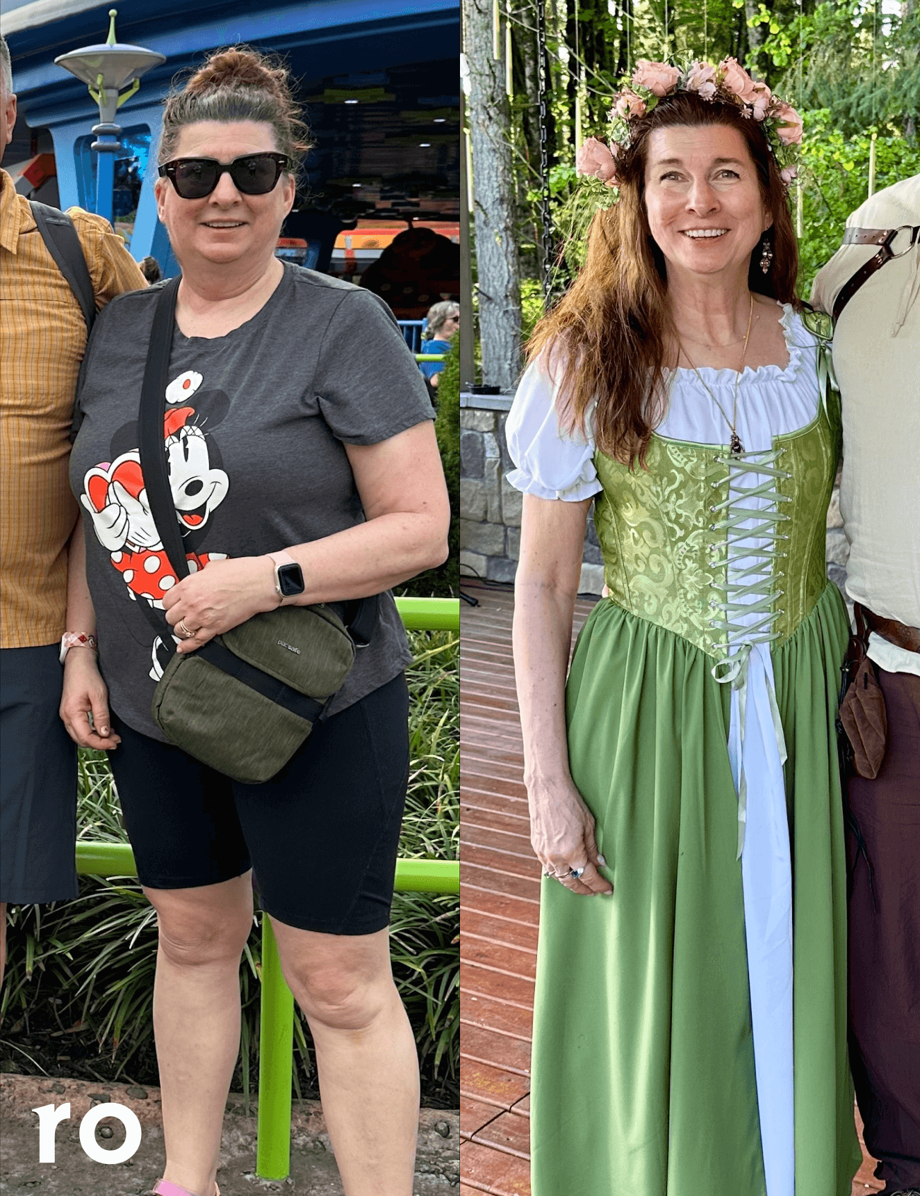 4 Zepbound Before and After Stories From Real Patients | Ro