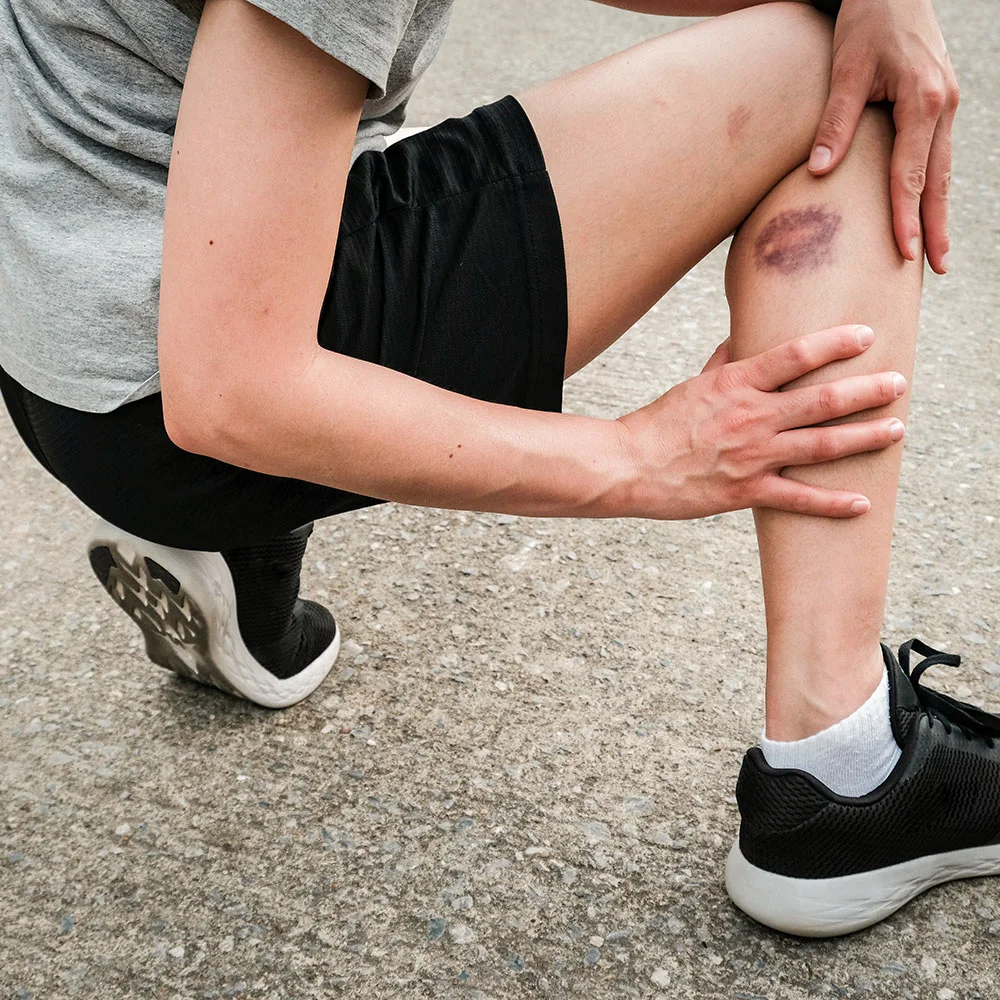 Vitamin K deficiency: symptoms, causes, treatment - Desktop Image