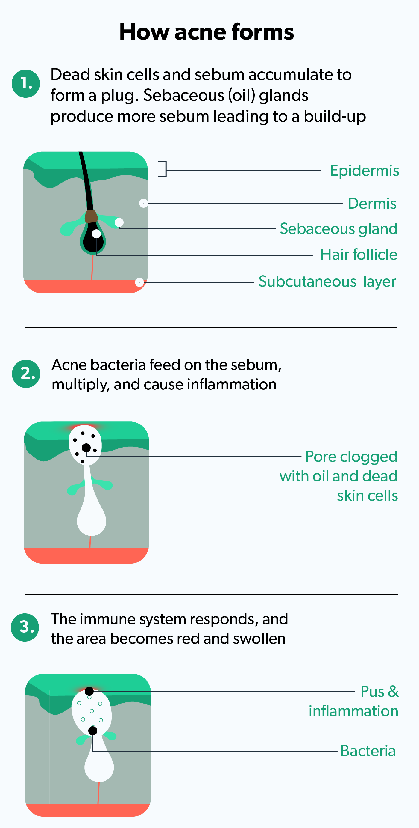 Accutane What Is It How Does It Work Risks Ro