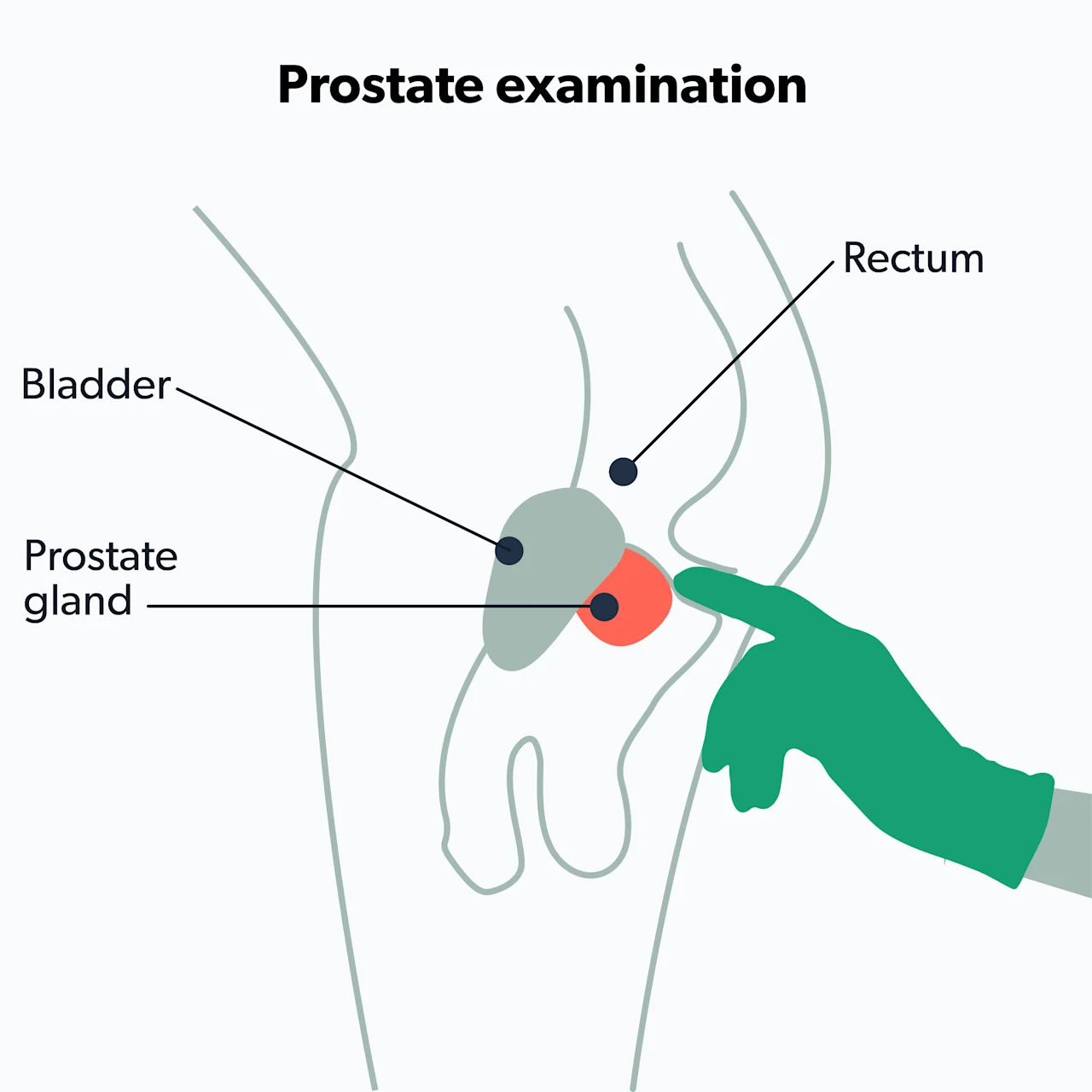 OC What to expect during a prostate exam image a48be80a-ad88-4d29-b905-190004bb372d