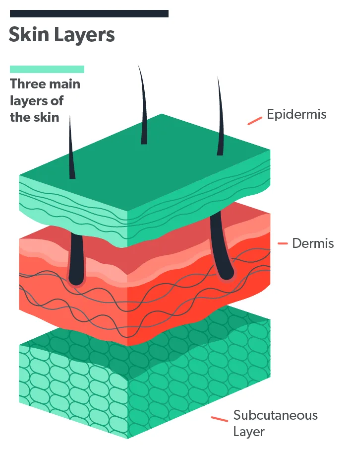 OC How to get rid of wrinkles: 12 wrinkle removing options image d97fc412-8cf6-49c2-a4cf-b4c6e28b436e