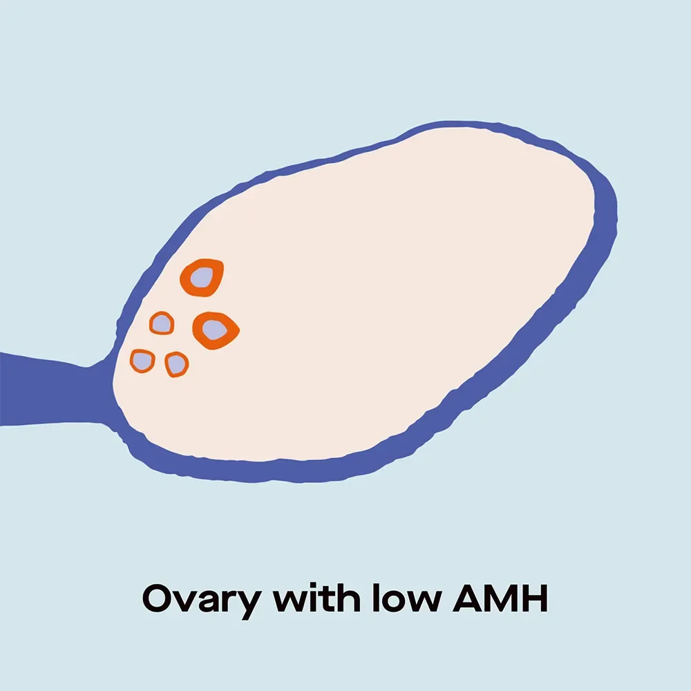 AMH Levels by Age Charts and Fertility Implications Ro