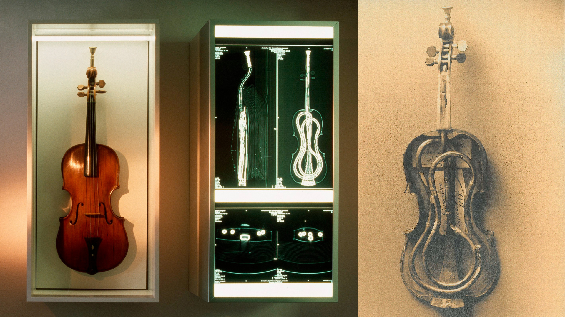 Trompetengeige Röntgen