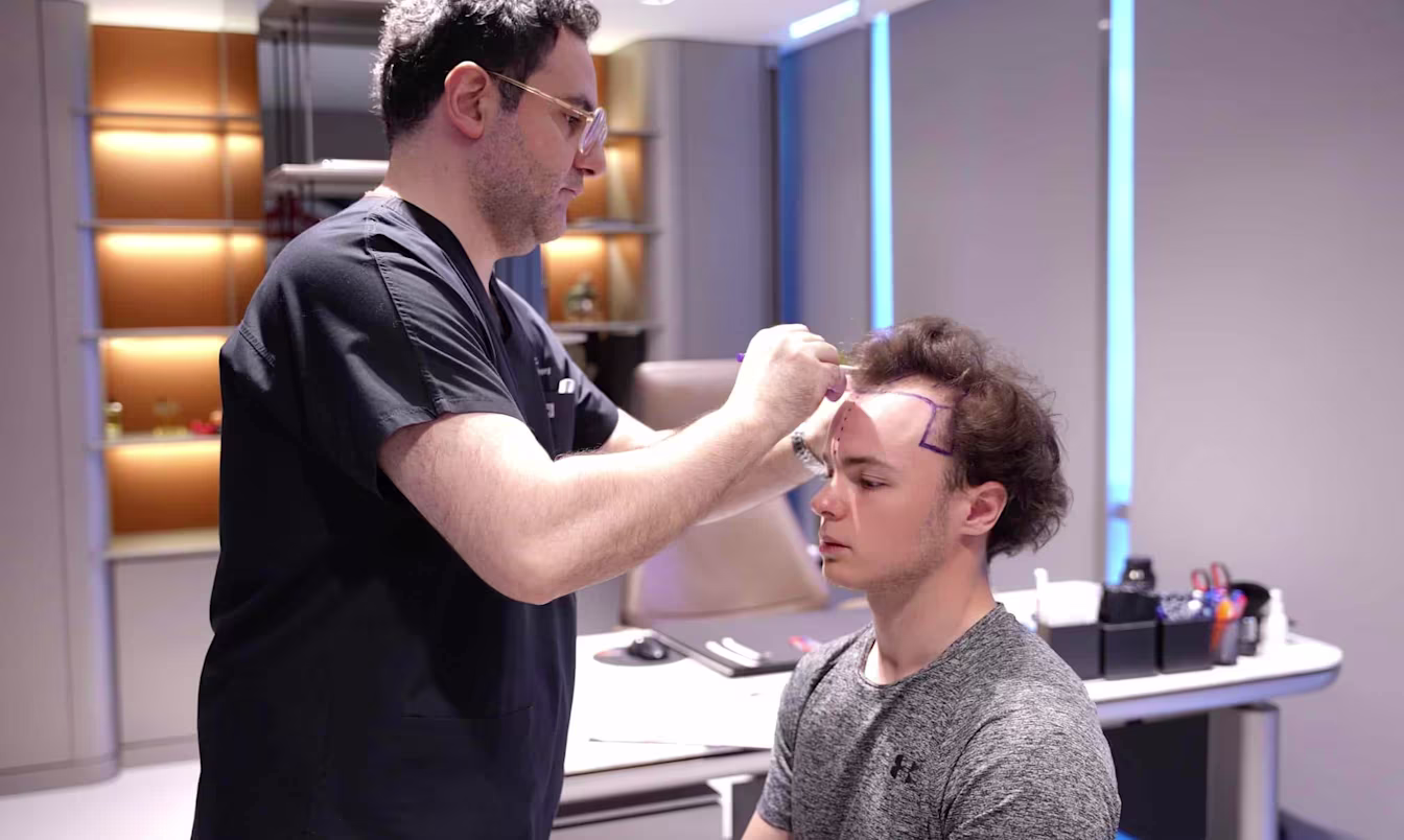 Haartransplantation auf höchstem medizinischem Niveau bei Cosmedica – Dr. Acar cosmedica