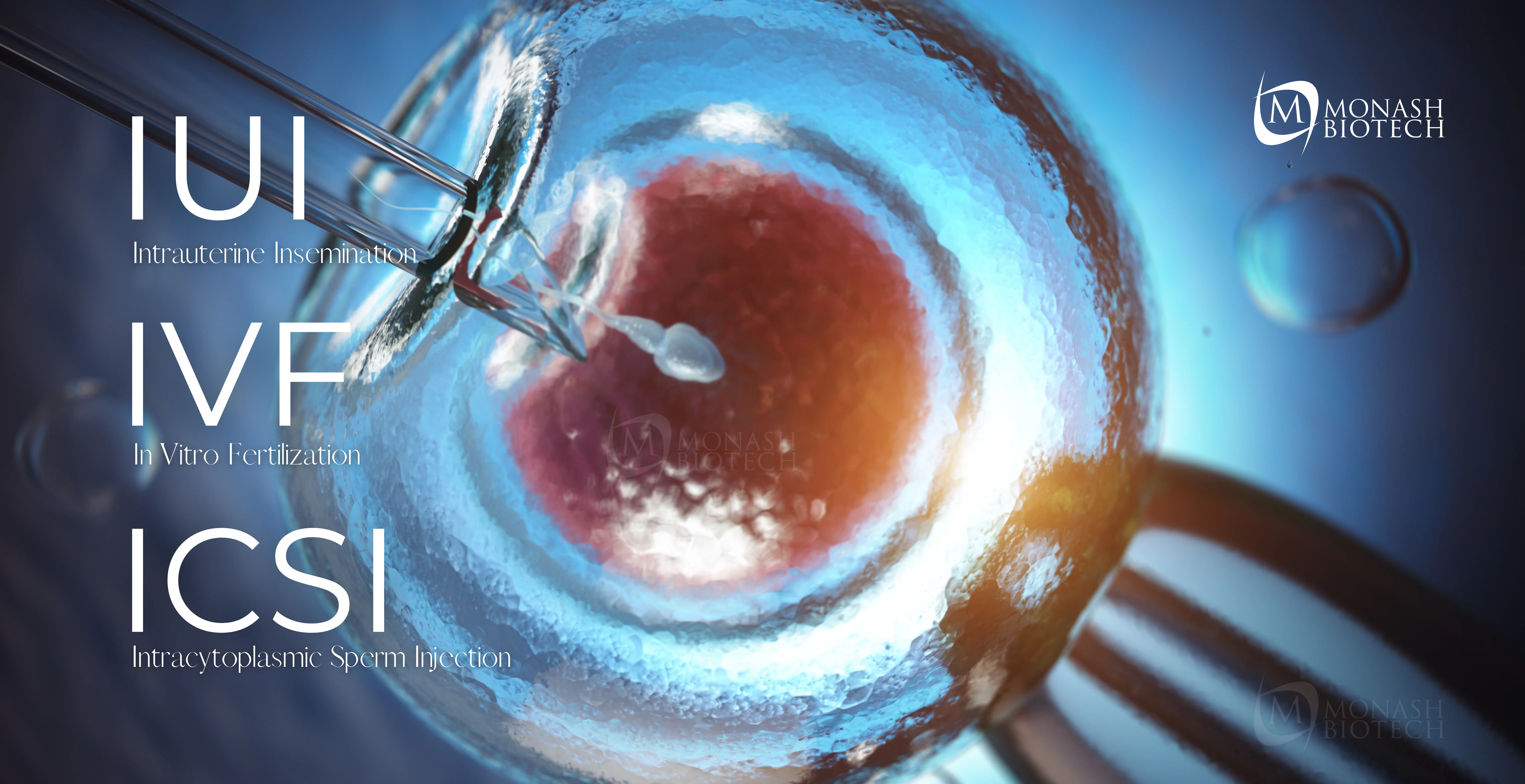 Decoding Fertility Treatments: IUI, IVF, and ICSI Explained
