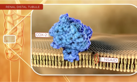 Thumbnail for a video explaining how NSAIDs’ inhibition of COX may compromise renal function.