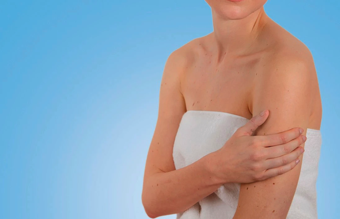 Gros plan sur la peau d'une personne