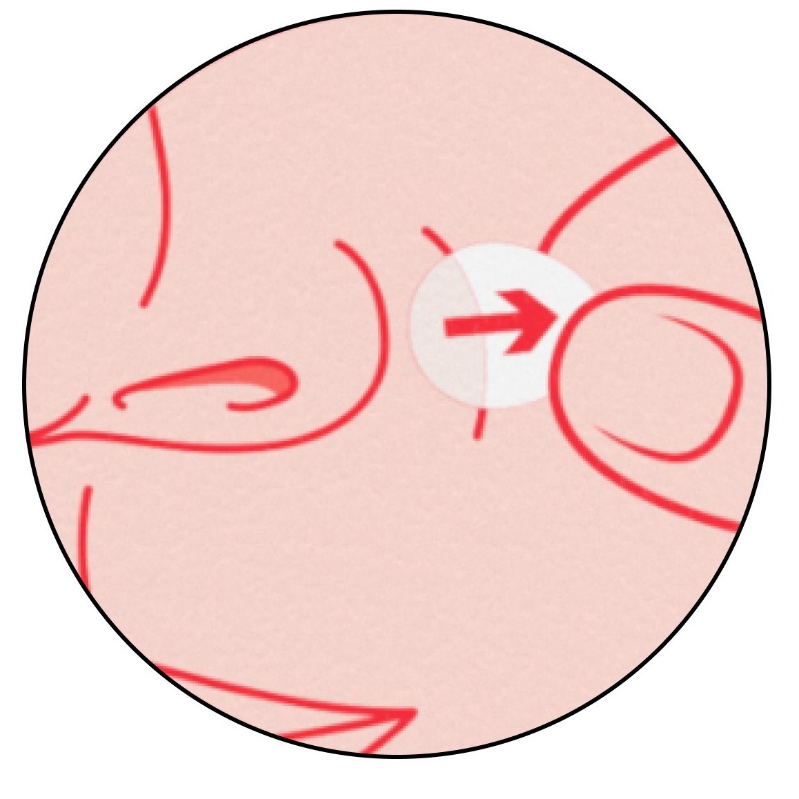 NA-US-NTG-Acne-MiniAcnePatch-Application-BTF2-Amazon-1464x600