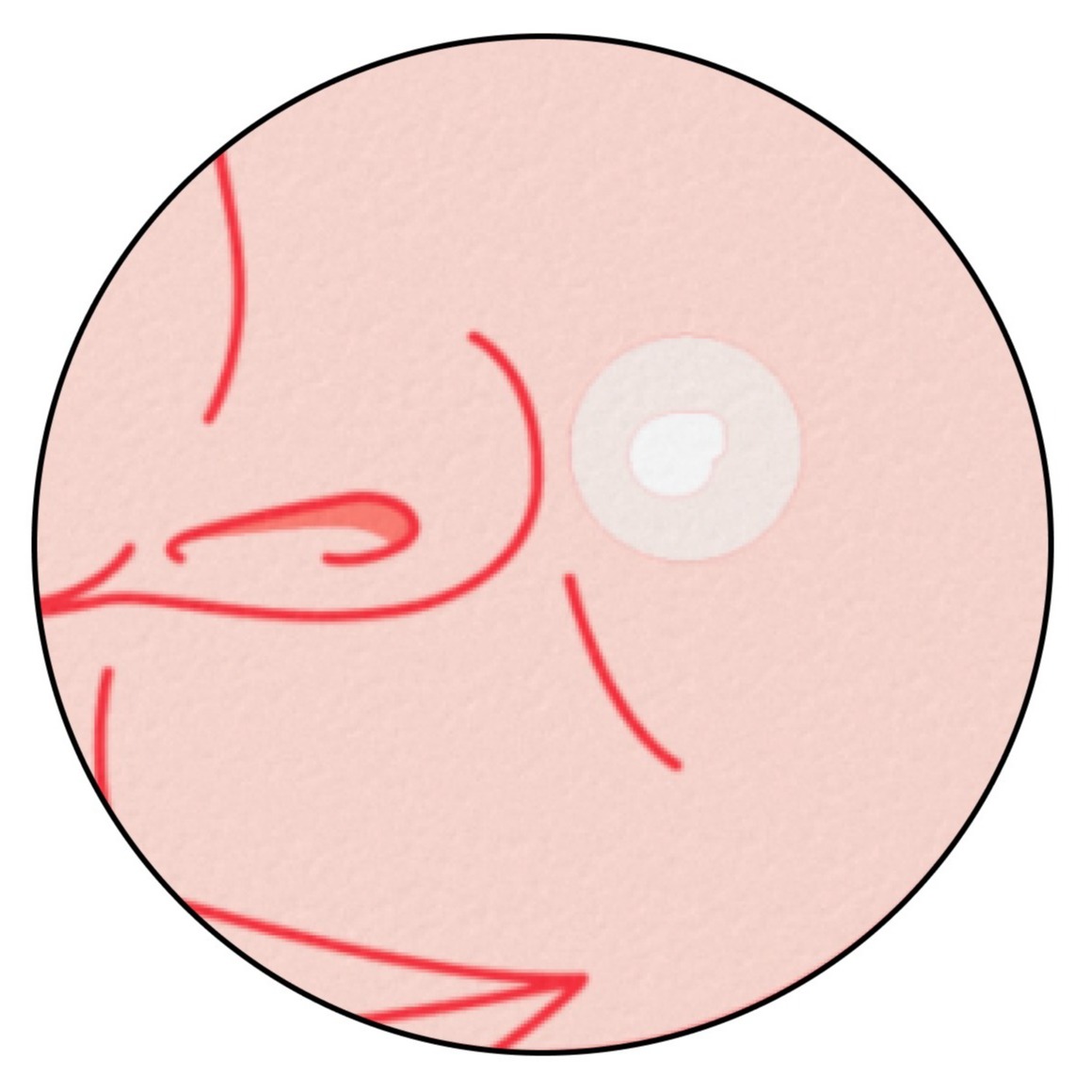 NA-US-NTG-Acne-MiniAcnePatch-Application-BTF2-Amazon-1464x600