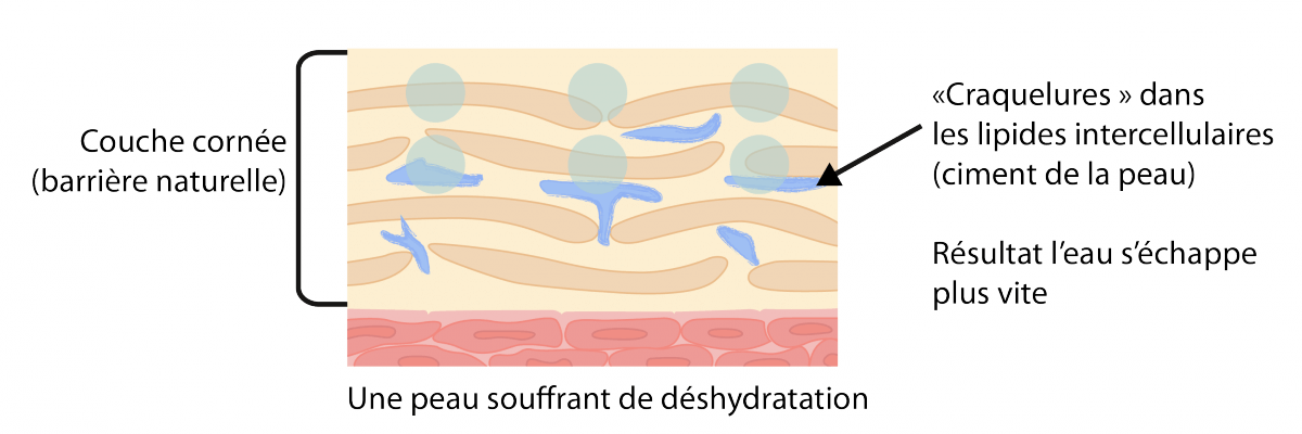 L’importance d’une barrière cutanée protégée | Peau deshydratee