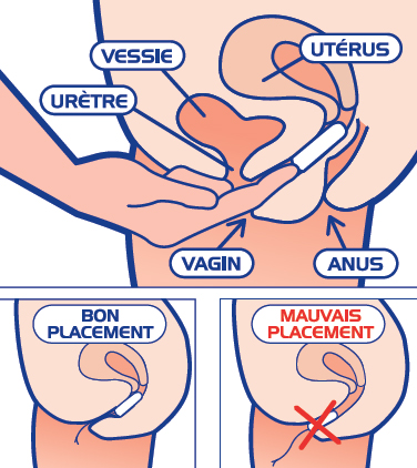 https://www.nett.fr/sites/www.nett.fr/files/images/schema-mettre-un-tampon.jpg