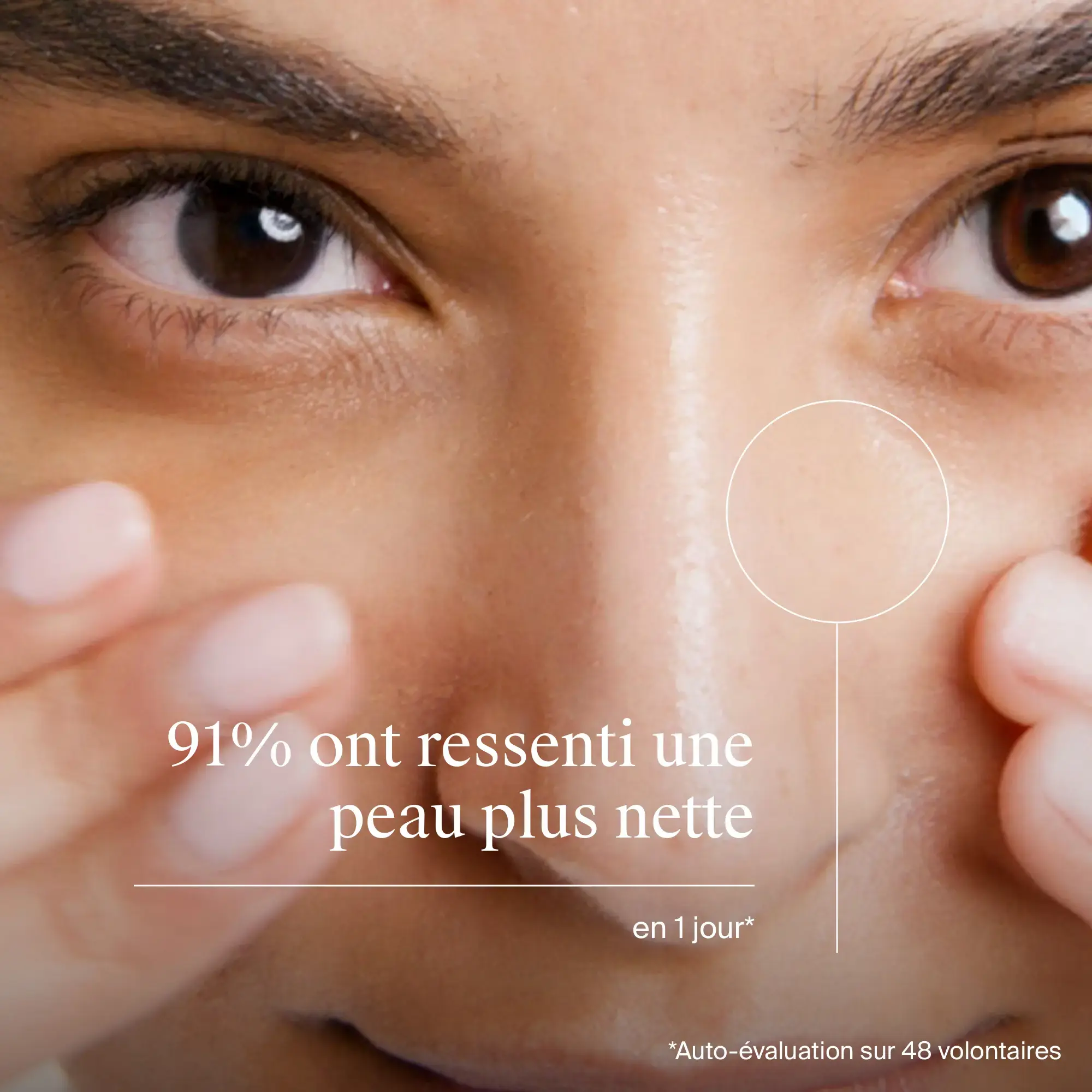 Anti-points noirs : lotion désincrustante