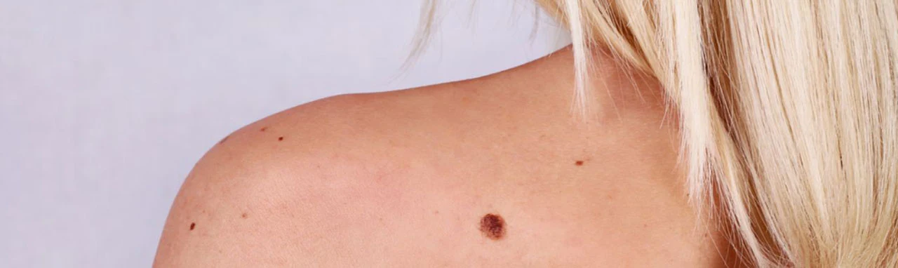 Photo de l'épaule nue d'une femme