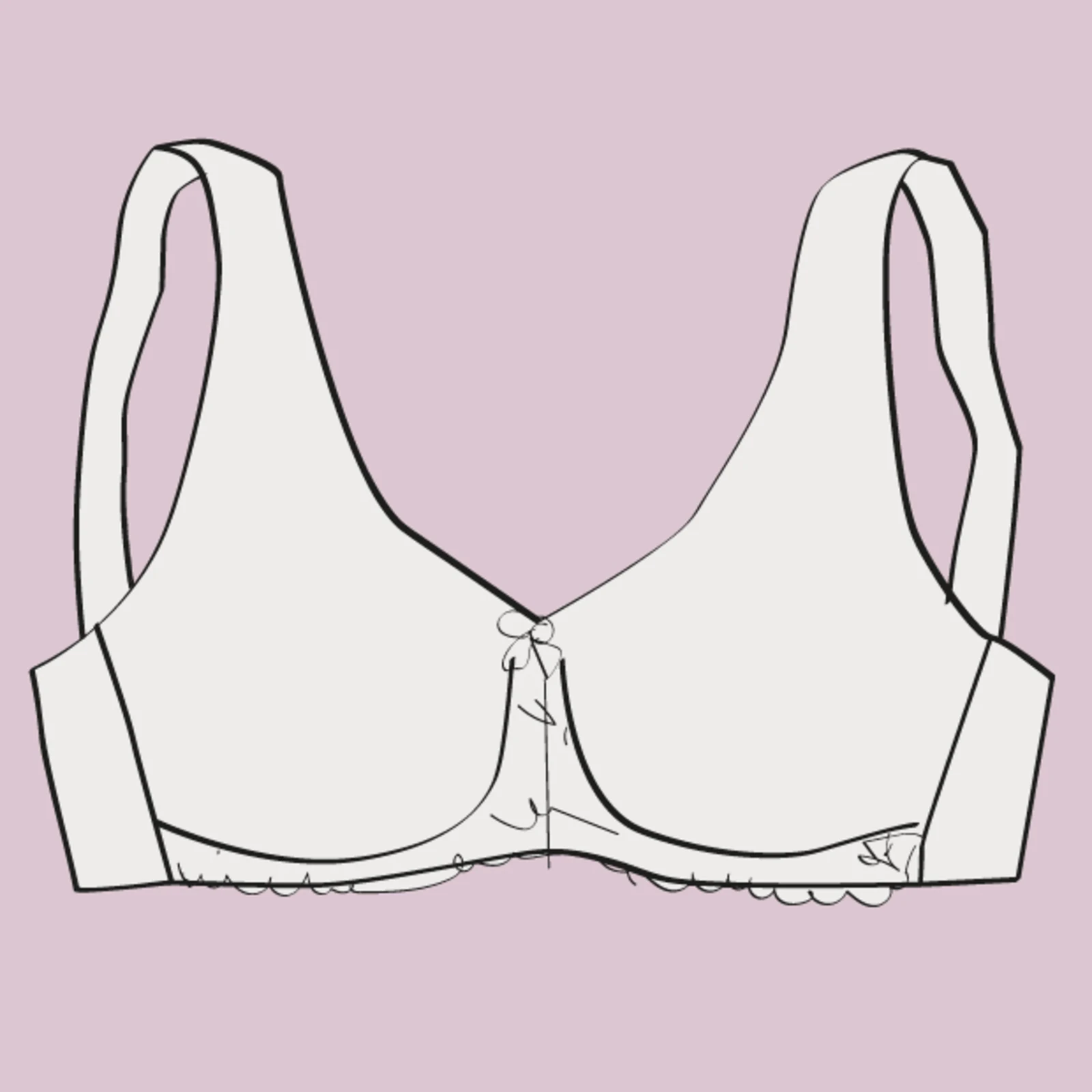 Schnittskizze eines Minimizer oder Entlastung BHs