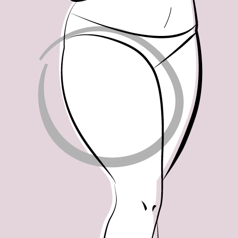 Illustration mit eingekreistem Oberschenkel