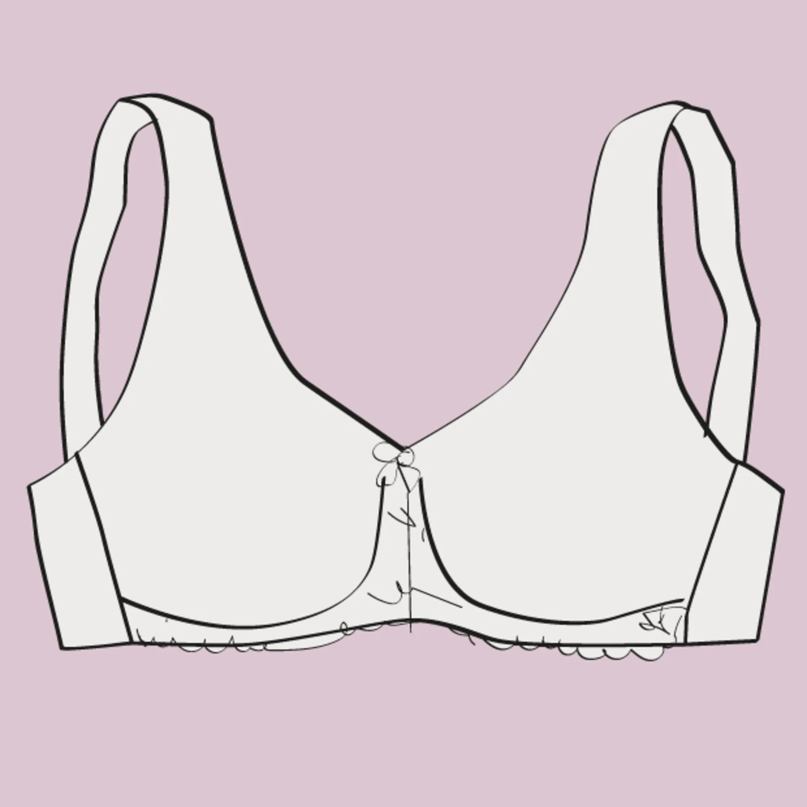 Schnittskizze eines Minimizer oder Entlastung BHs