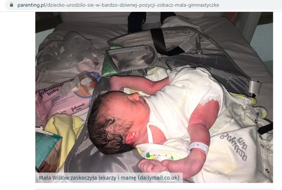 Screen z materiału portalu parenting.pl pt. „Dziecko urodziło się w bardzo dziwnej pozycji. Zobacz małą gimnastyczkę” pod adresem https://parenting.pl/dziecko-urodzilo-sie-w-bardzo-dziwnej-pozycji-zobacz-mala-gimnastyczke 