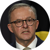 Anthony Albanese