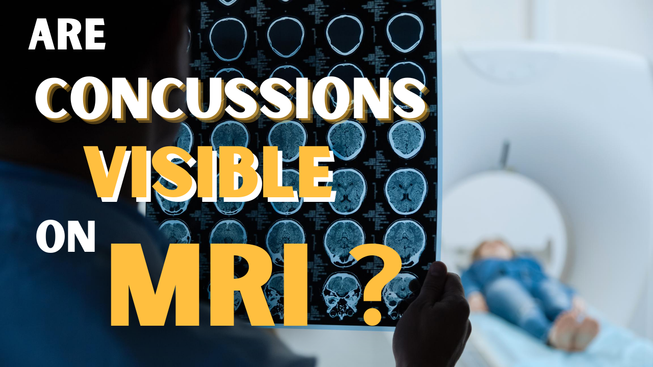 concussion detected on MRI