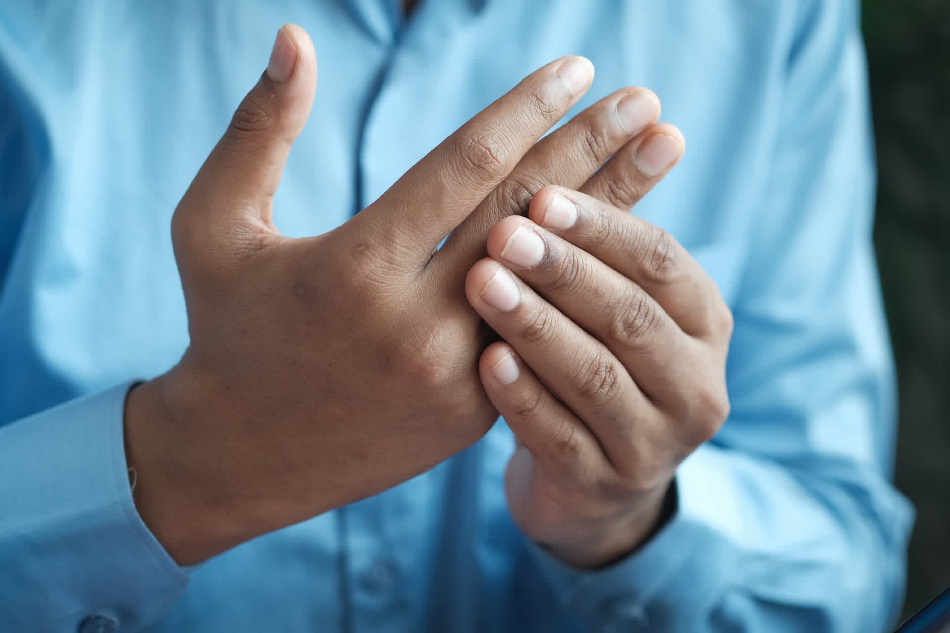 Person with arthritis holding painful hands
