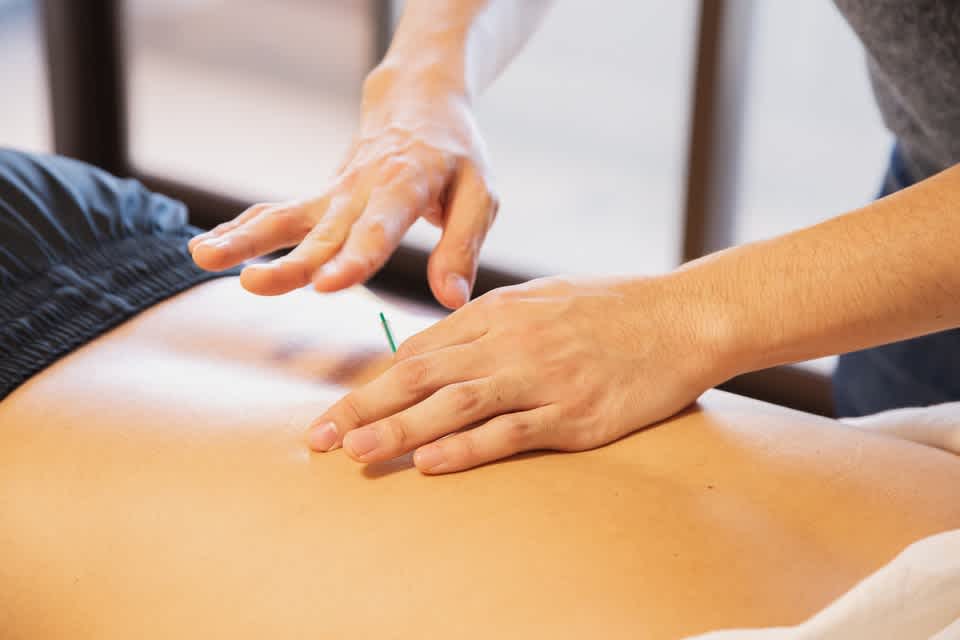 Is Acupuncture Part of Massage Therapy
