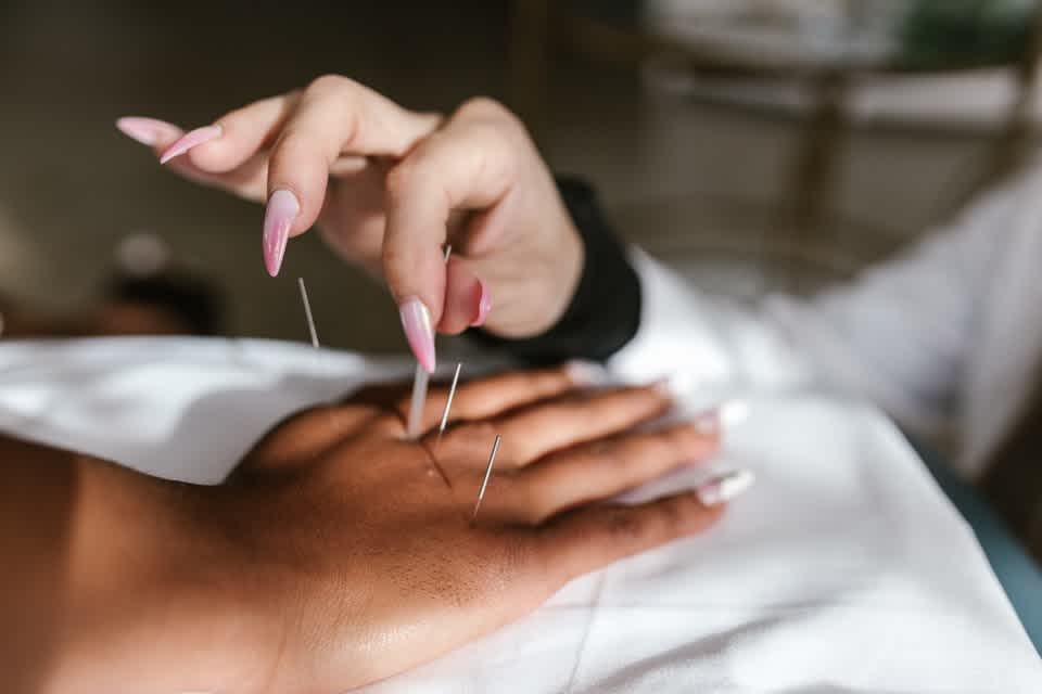 What Should Clients Not Do Before Acupuncture