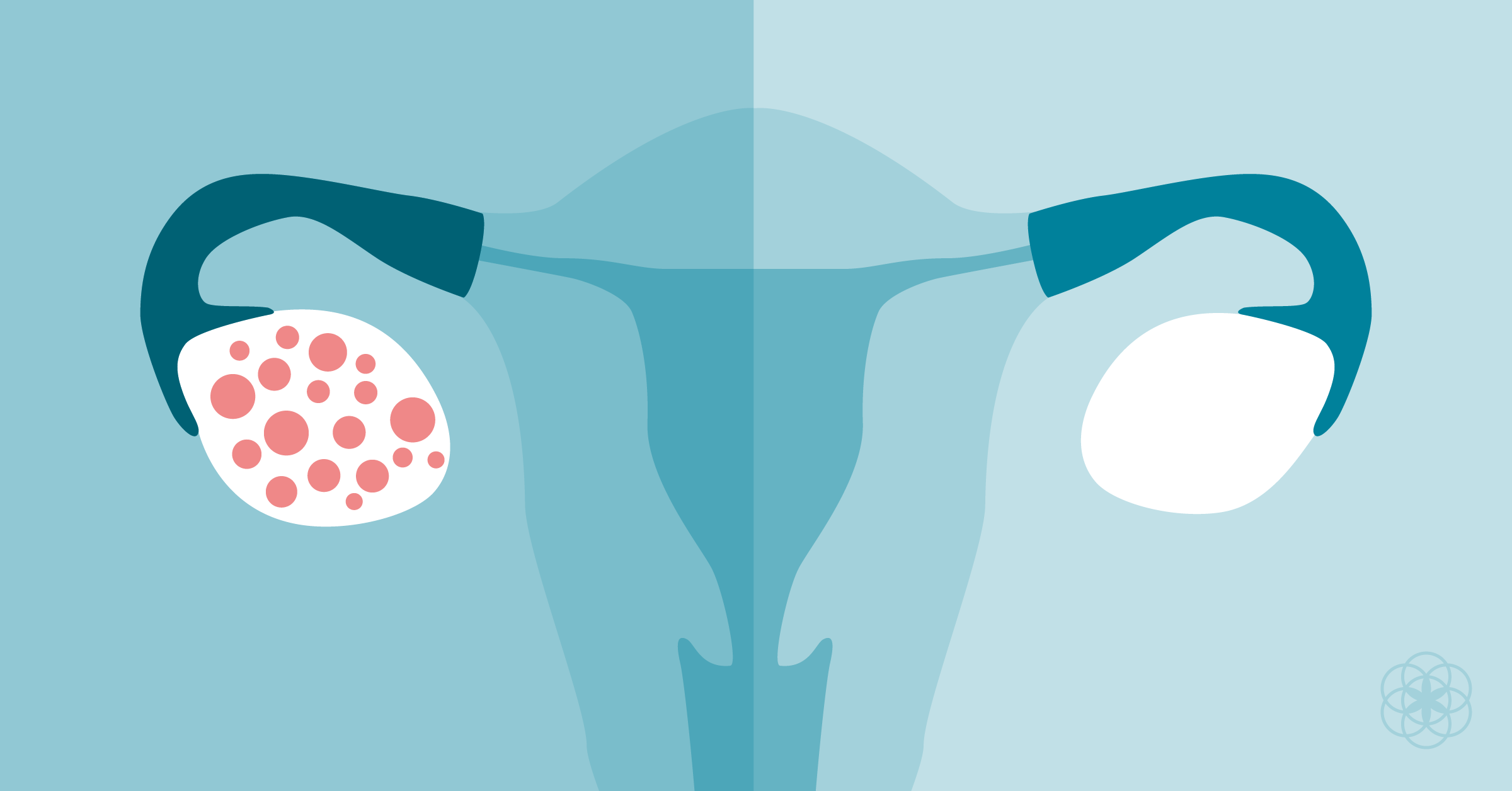 Menstruação desregulada: Causas e quando procurar auxílio médico