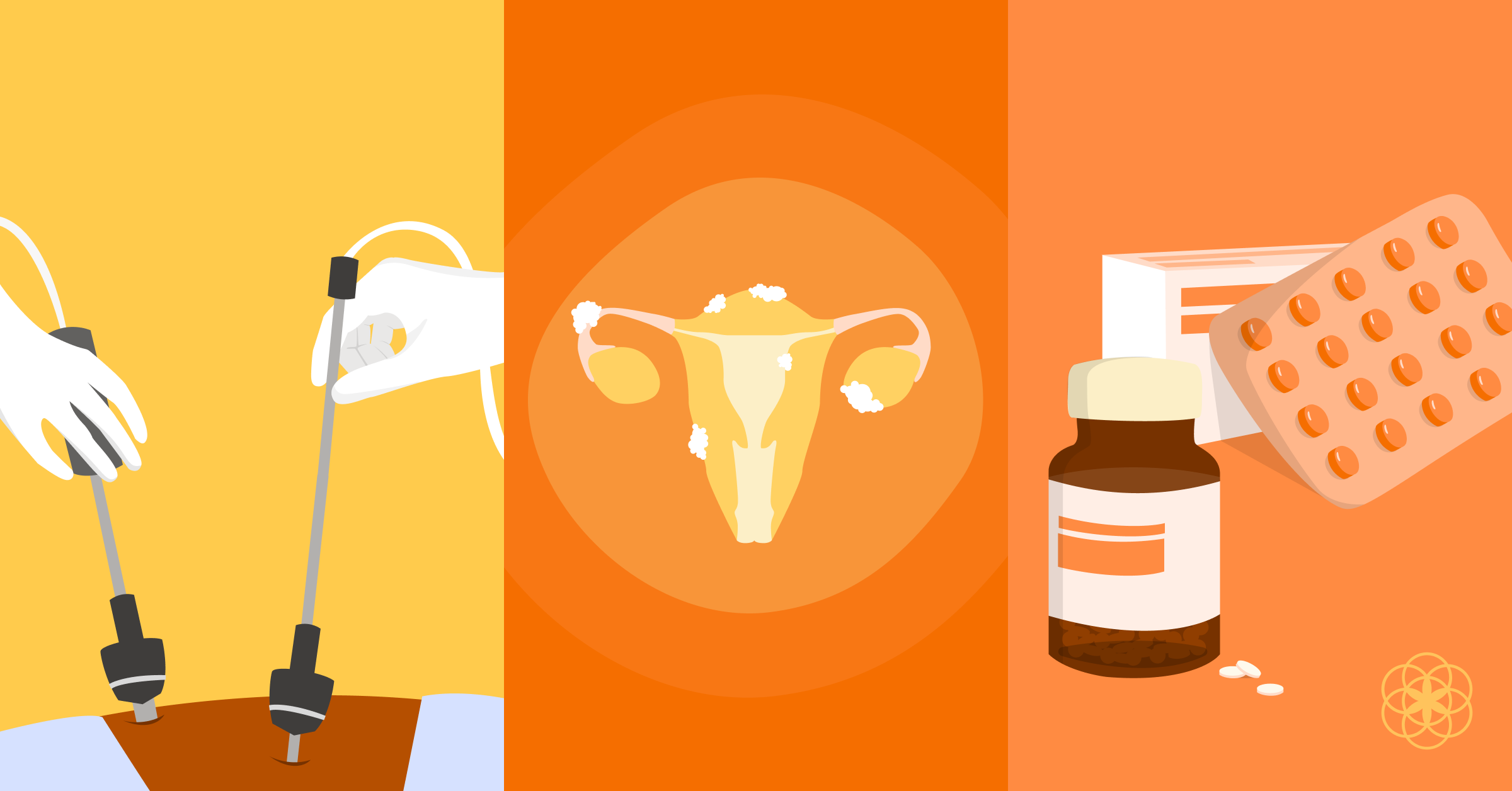 Instrumentos quirúrgicos apuntando hacia adentro formando un círculo alrededor de un trozo de tejido similar al endometrio