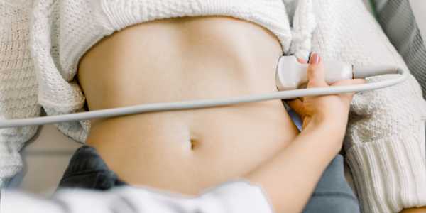 A woman's body getting an ultrasound to check for endometriosis