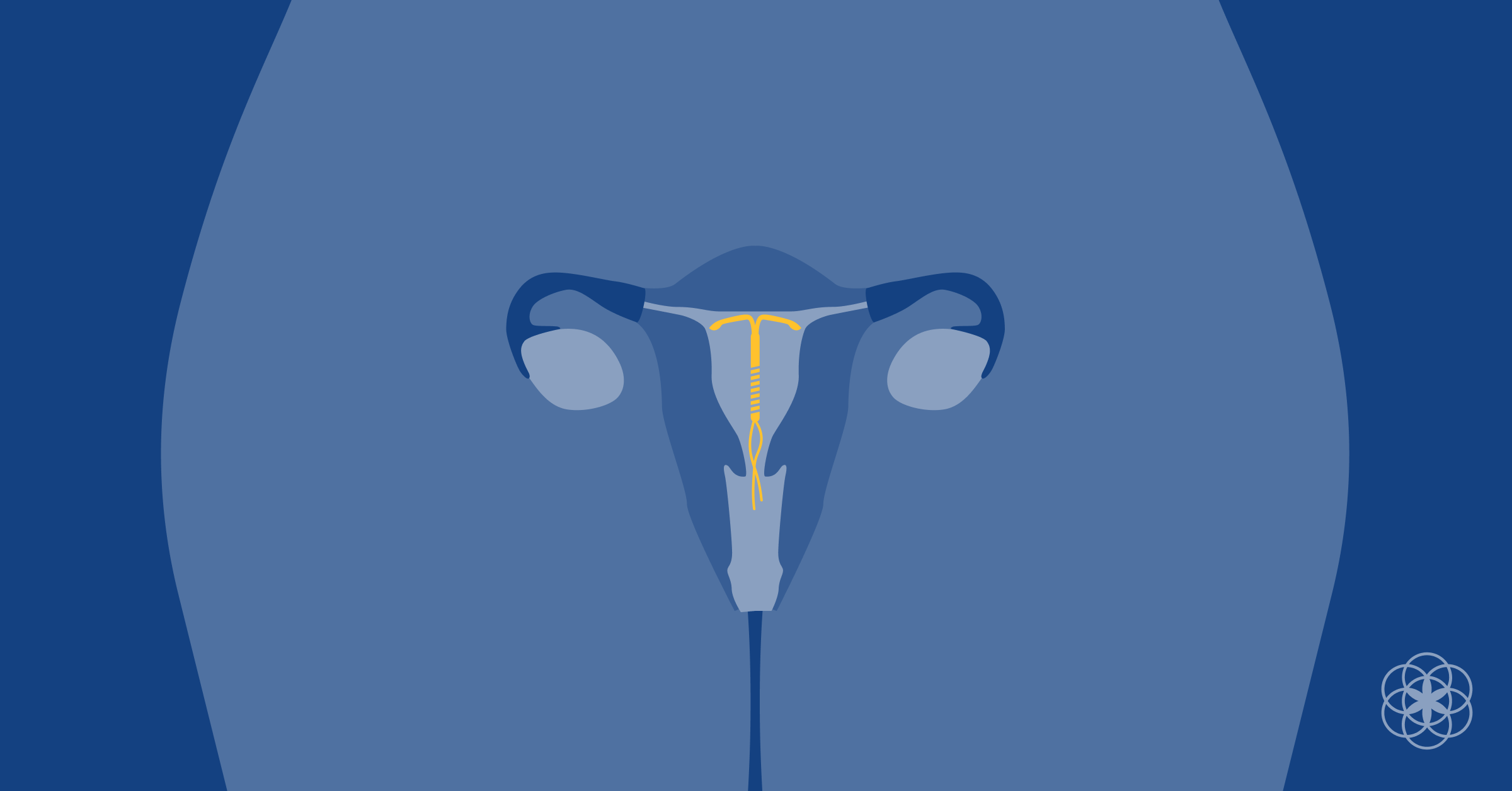 Can the Mirena IUD cause Menopause-like Symptoms in the Vagina?