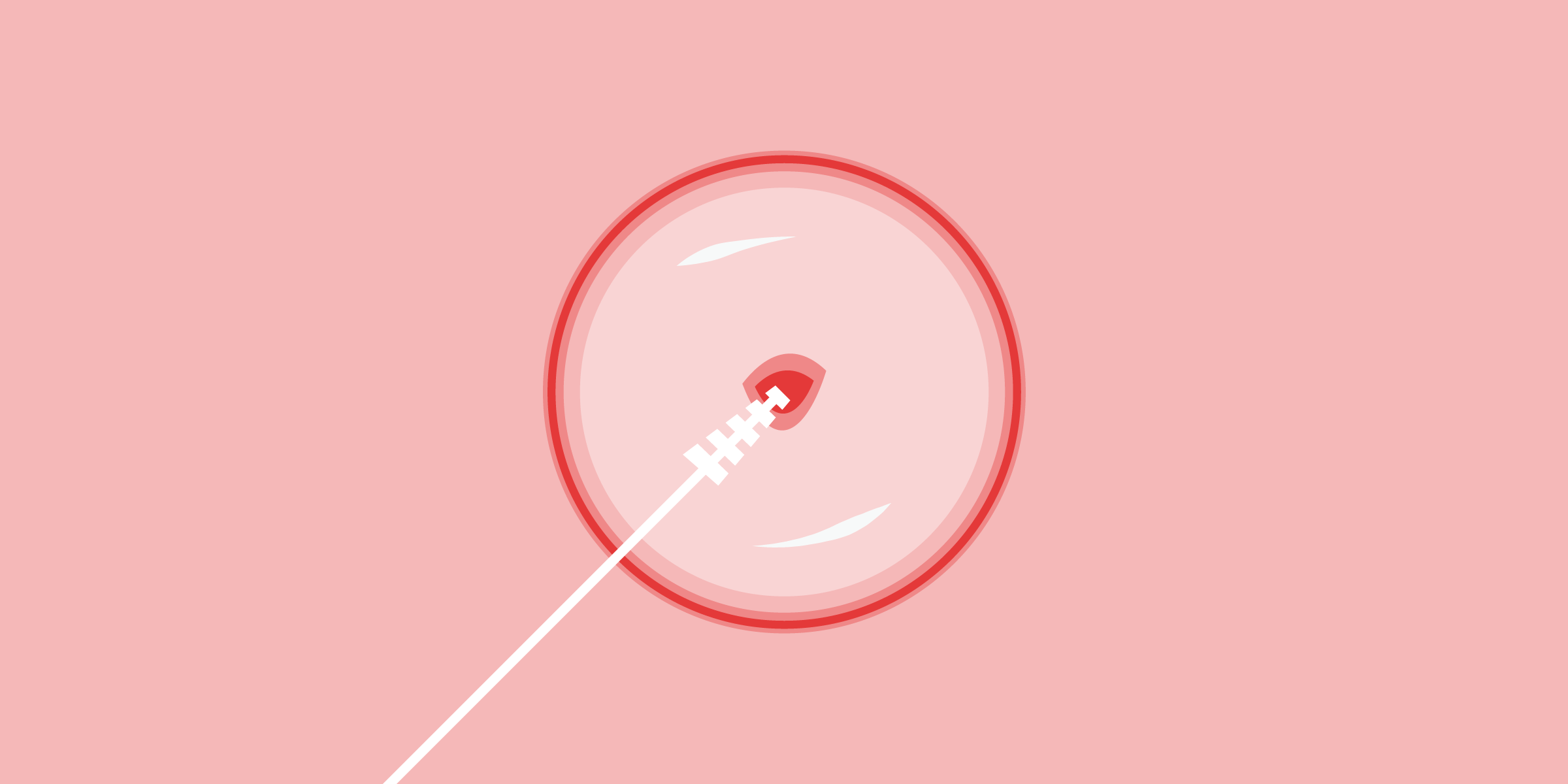 Gynecological pelvic exams & Pap tests 101