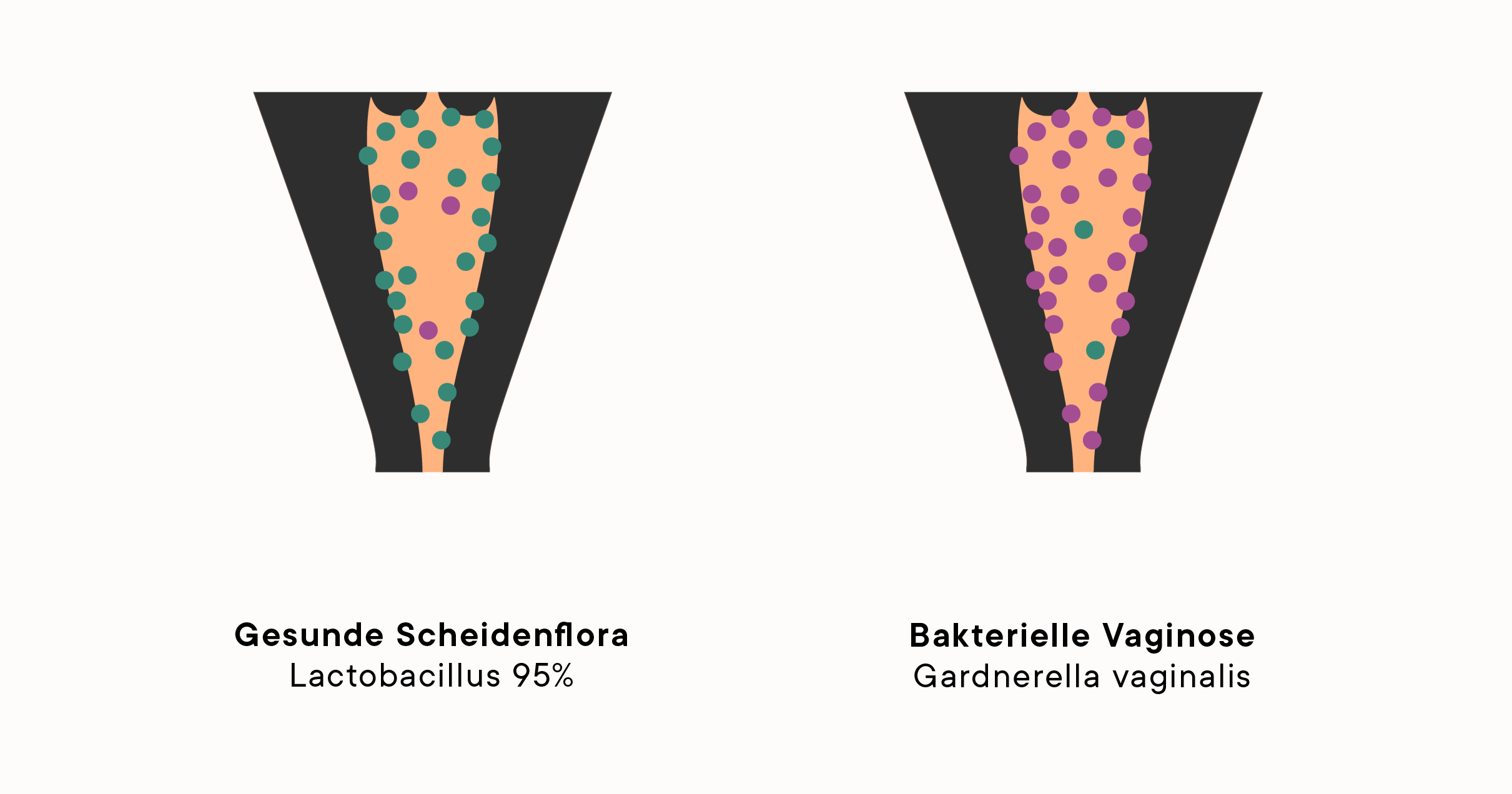 comparative illustration of two vaginal muscoa, one healthy and one with bacterial vaginosis
