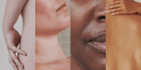 Quatre faces partielles sont représentées, avec différents types de peau.