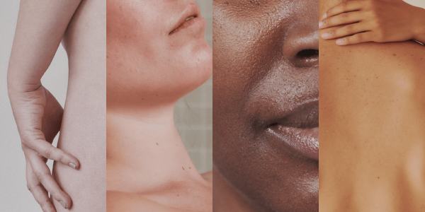 Four partial faces are shown, with different skin types.