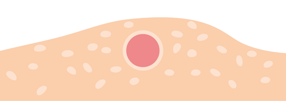Ilustración de células humanas y óvulos en tejido ovárico.