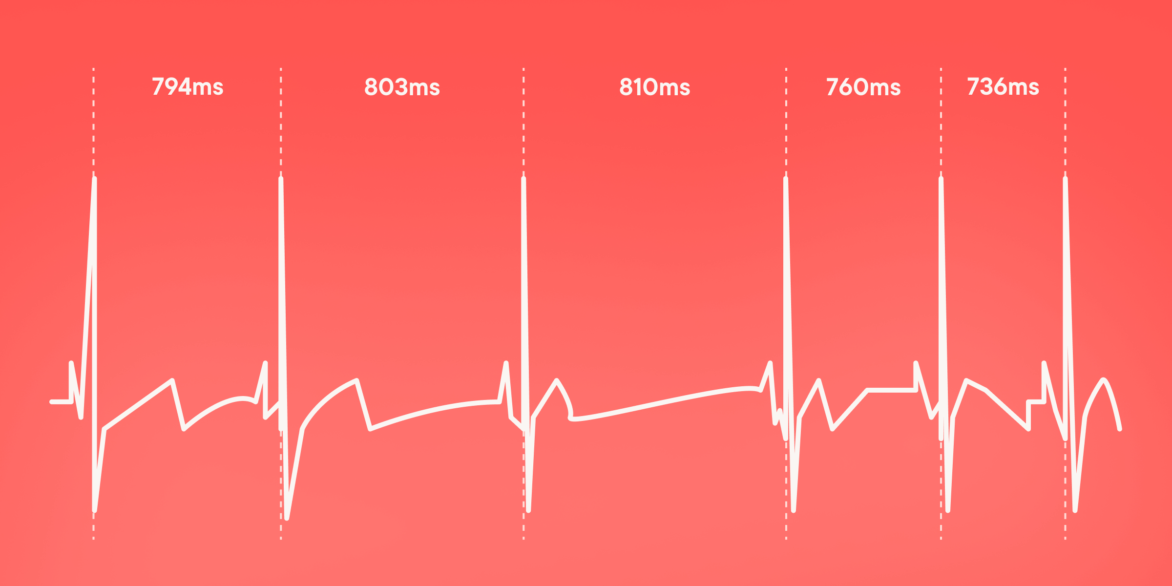 Graph showing heart rate variability 