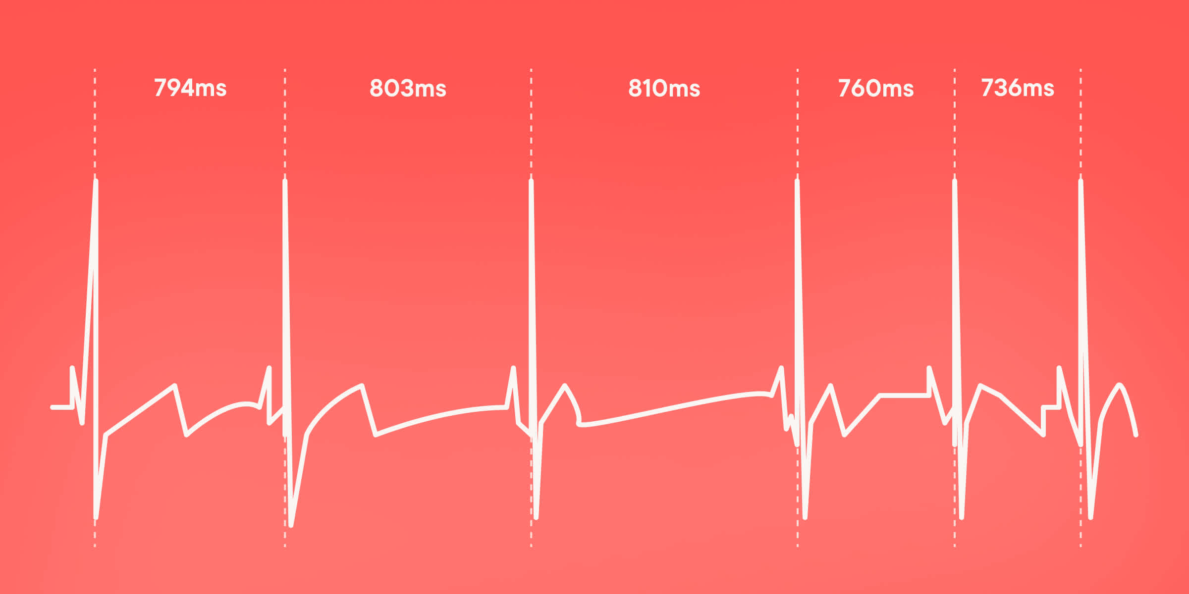 Graph showing heart rate variability