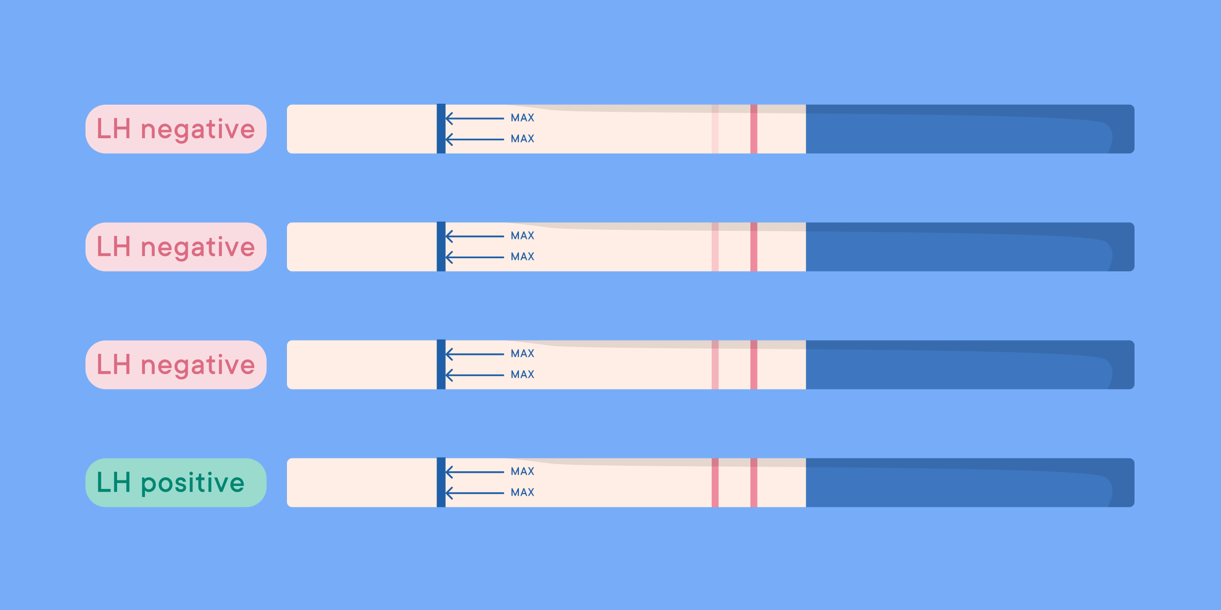 Illustration of ovulation strip tests, four negative and one positive.