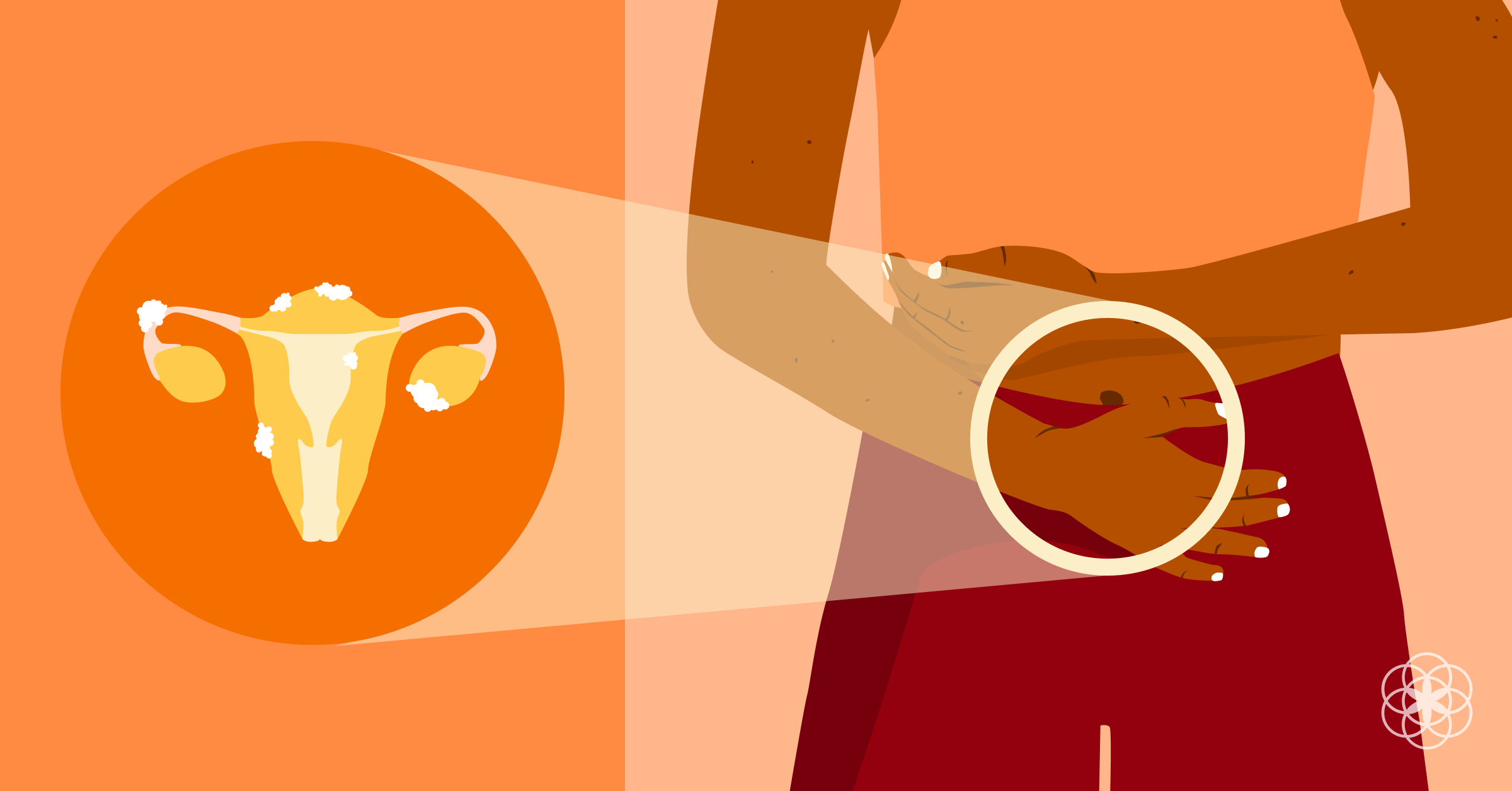 Endometriose Symptome Diagnose und Behandlung 