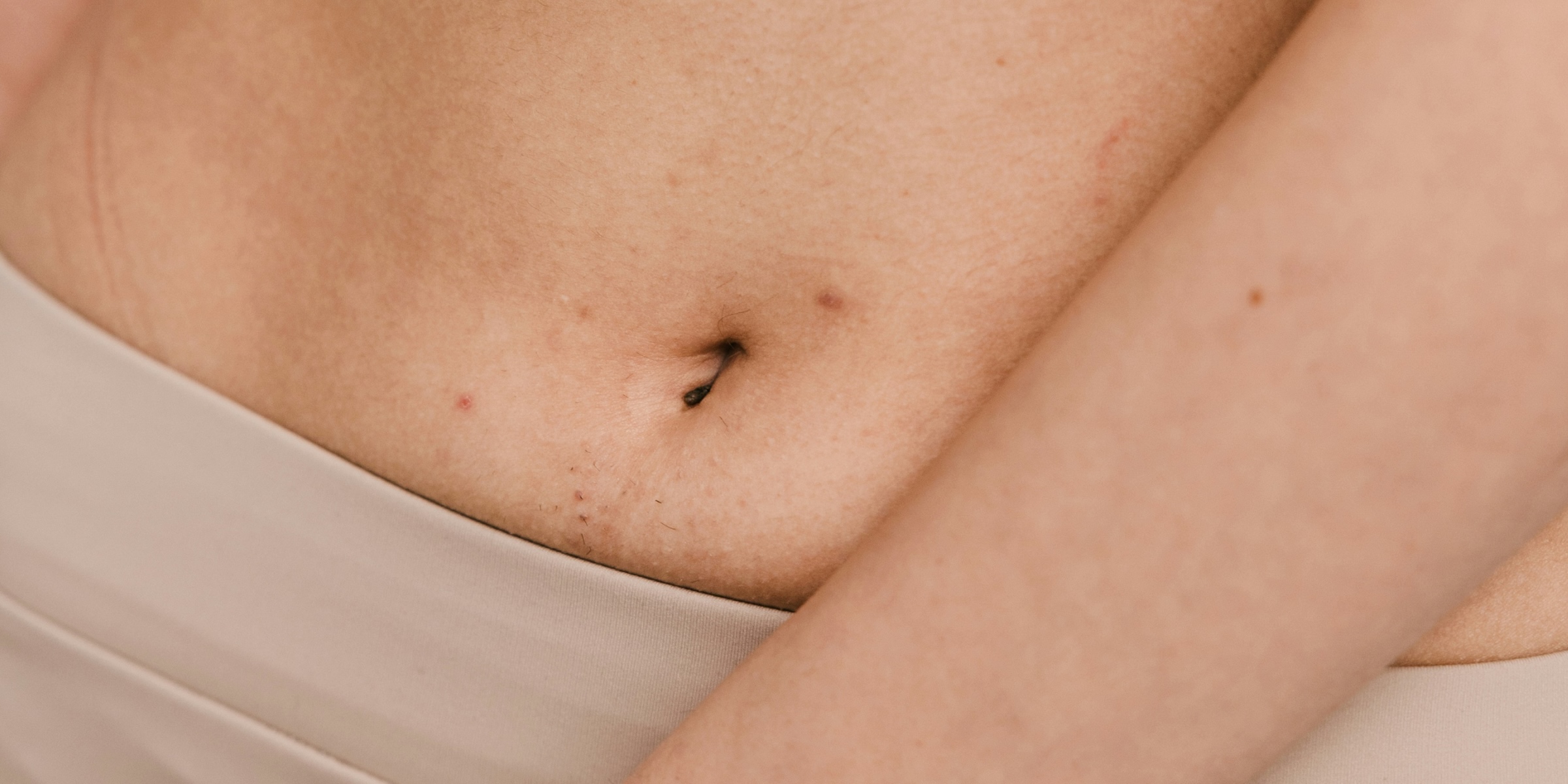 Close-up of a person's lower abdomen and belly button above a beige waistband, with an arm resting across their body.