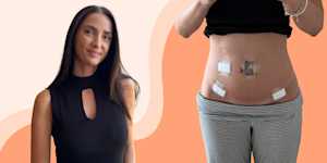 Headshot of Lisa and a picture of her stomach with bandages