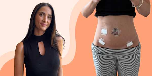 Headshot of Lisa and a picture of her stomach with bandages
