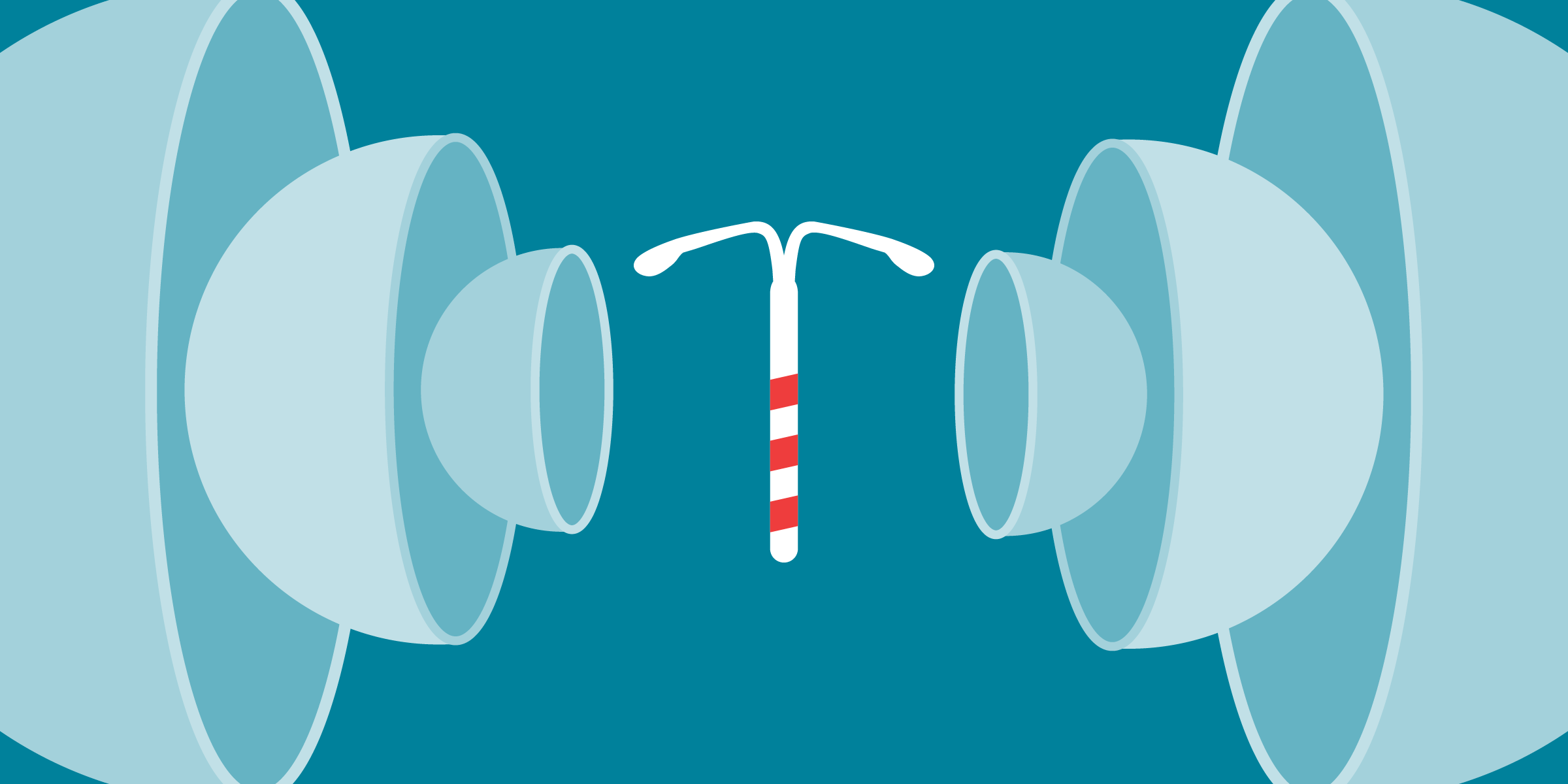 An illustration of an IUD.