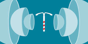 An illustration of an IUD.
