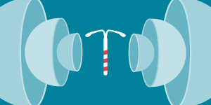 An illustration of an IUD.