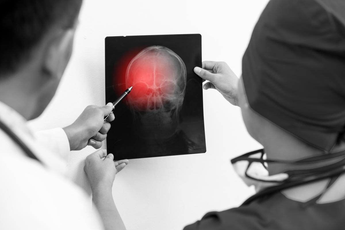 Symptoms of a Mild Traumatic Brain Injury | Long-term Consequences | How They Impact Settlement Amounts