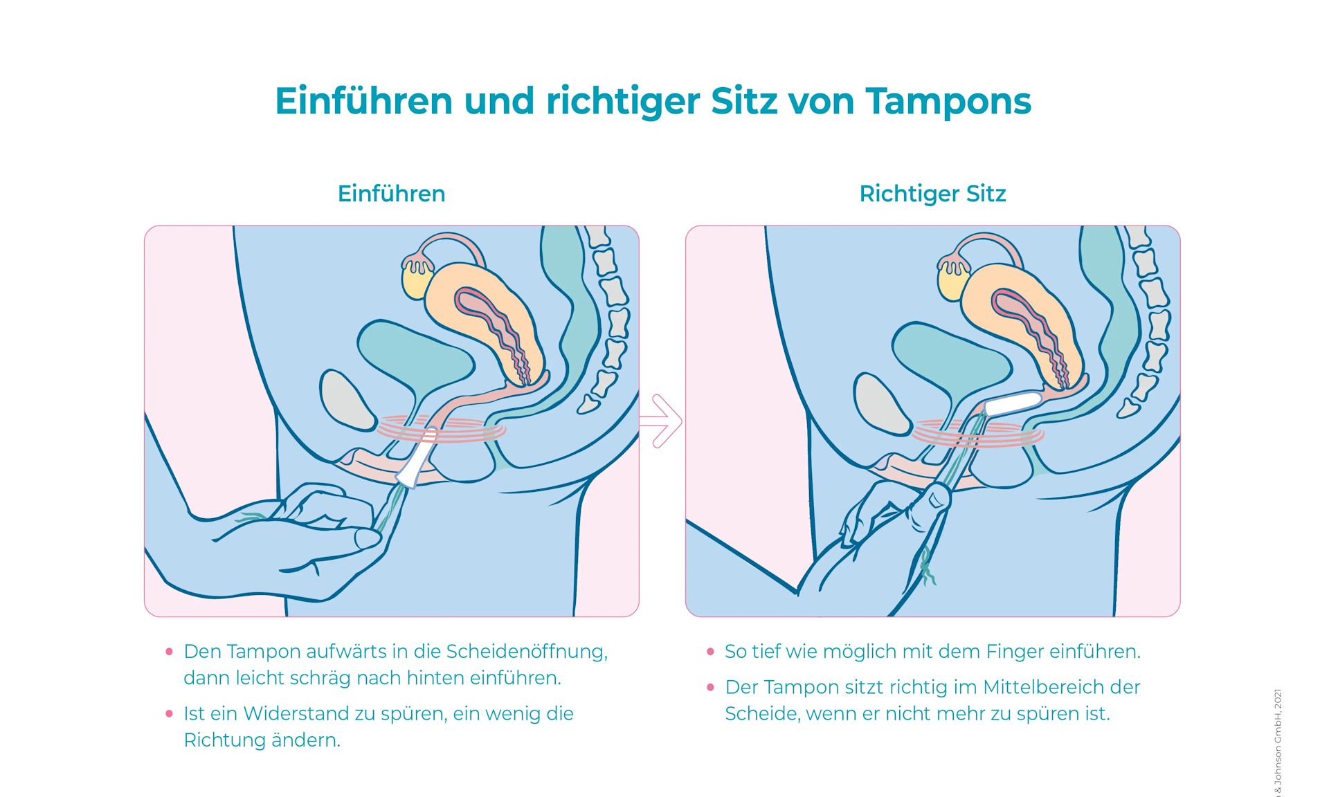 Anleitung zum Einführen und Sitz des Tampons