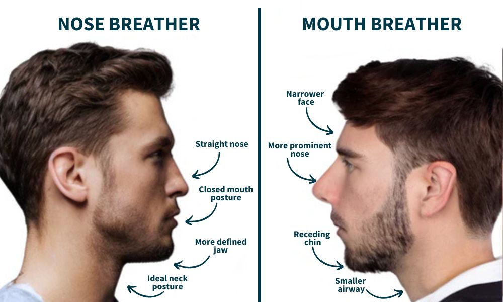 Nose brether and mouth breather