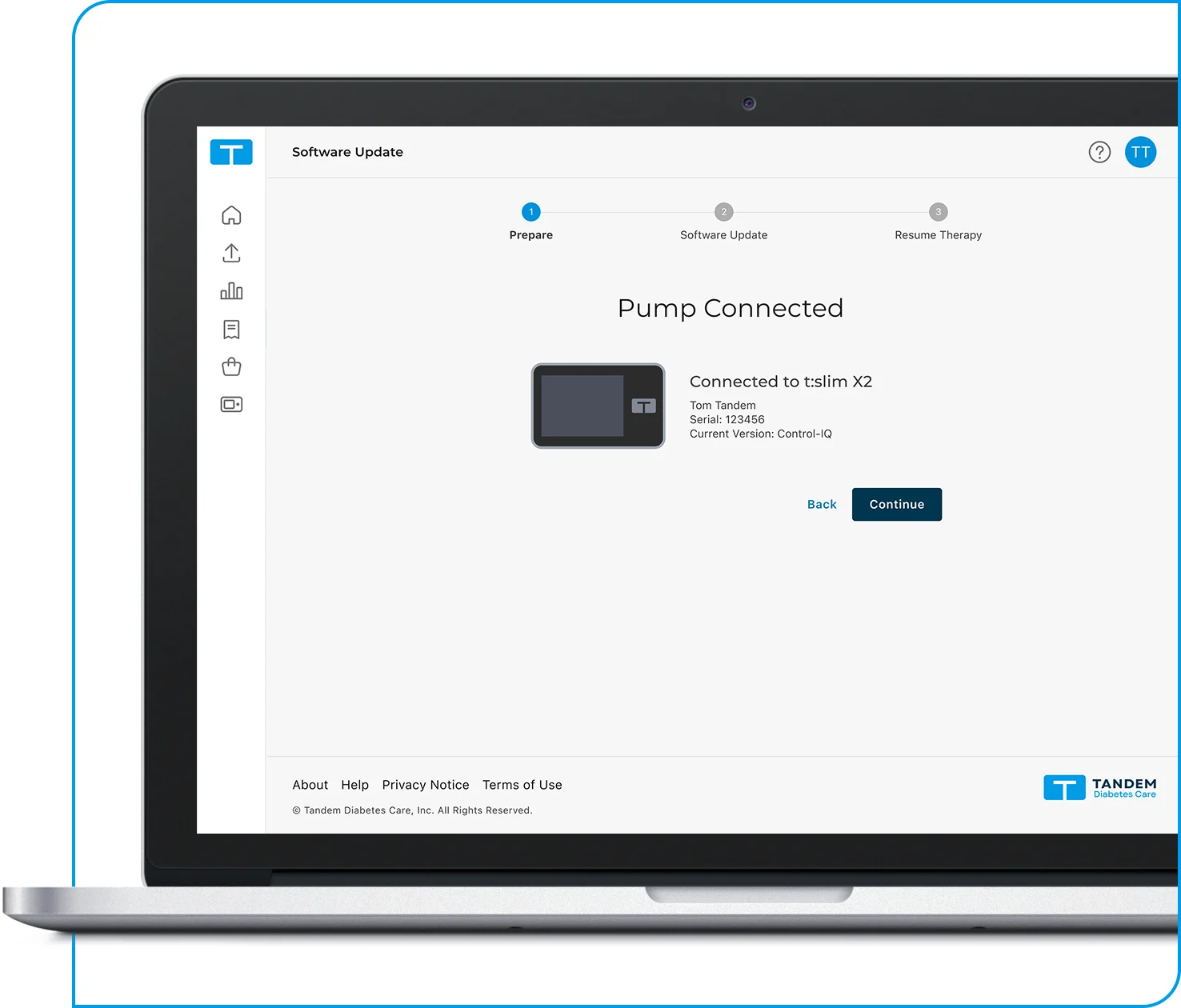 Tandem Source platform, Pump Connected screen