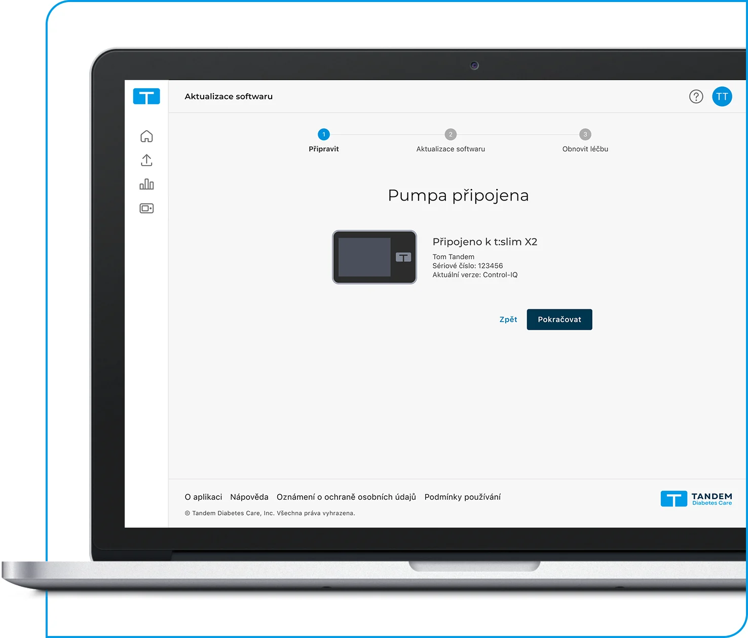 Tandem Source platform, Pump Connected screen